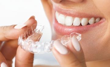 Want straight teeth? Wear retainers for life