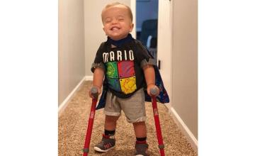 A little boy with spina bifida becomes an Internet sensation