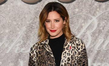 Ashley Tisdale shares years-long struggle with hair loss after alopecia diagnosis